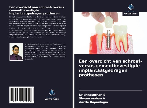 Een overzicht van schroef- versus cementbevestigde implantaatgedragen prothesen - Krishnasuthan S, Shyam Mohan A, Aarthi Rajambigai
