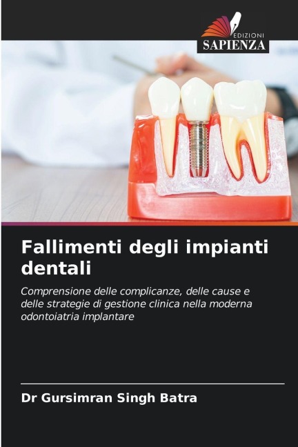 Fallimenti degli impianti dentali - Gursimran Singh Batra