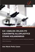 Cover-Bild zum Titel 'IL6 I ANALIZA ¿ELAZA PO CA¿KOWITEJ ALLOPLASTYCE STAWU KOLANOWEGO' von 'Ana María Peña Casas'