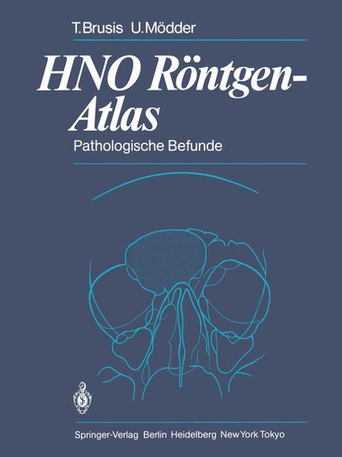 HNO Röntgen-Atlas - Tilman Brusis, Ulrich Mödder