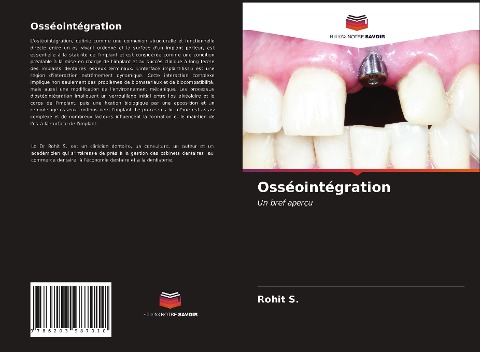Osséointégration - Rohit S.
