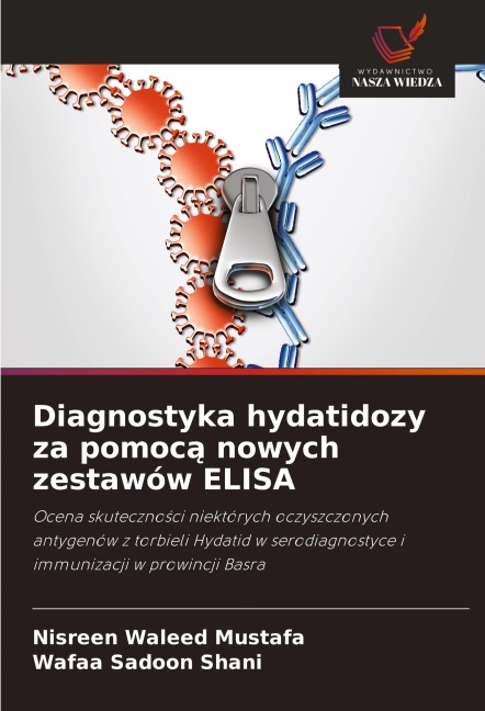 Diagnostyka hydatidozy za pomoc¿ nowych zestawów ELISA - Nisreen Waleed Mustafa, Wafaa Sadoon Shani