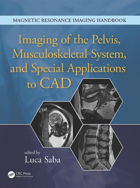 Imaging of the Pelvis, Musculoskeletal System, and Special Applications to CAD - 