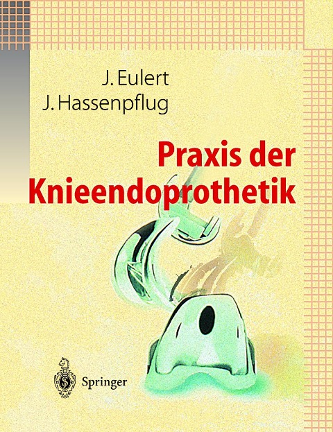 Praxis der Knieendoprothetik - 