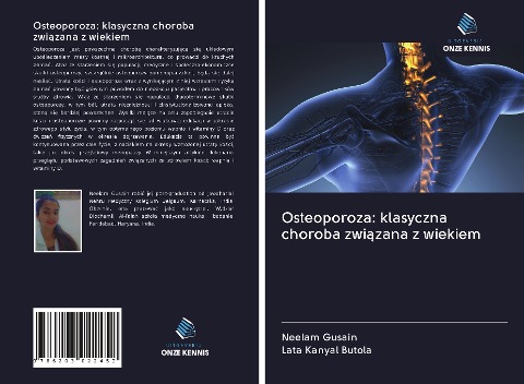 Osteoporoza: klasyczna choroba zwi¿zana z wiekiem - Neelam Gusain, Lata Kanyal Butola