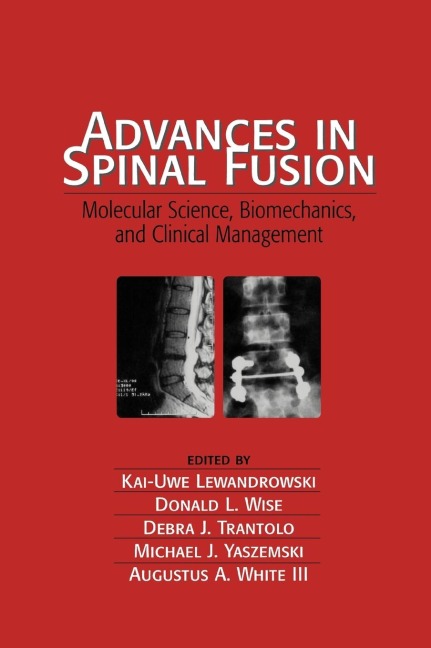 Advances in Spinal Fusion - Kai-Uwe Lewandrowski