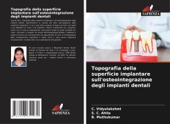 Cover-Bild zum Titel 'Topografia della superficie implantare sull'osteointegrazione degli impianti dentali' von 'C. Vidyalakshmi, S. C. Ahila, B. Muthukumar'