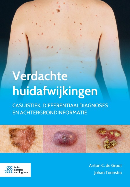 Verdachte huidafwijkingen - Johan Toonstra, Anton C. De Groot