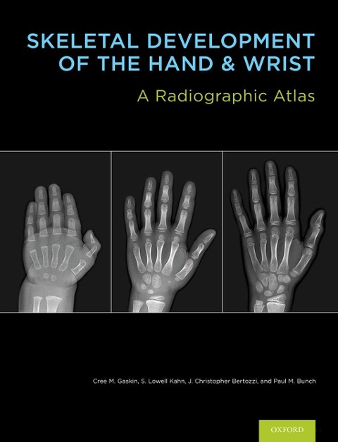 Skeletal Development of the Hand and Wrist - Cree M. Gaskin, S. Lowell, MD MBA Kahn, J. Christoper Bertozzi, Paul M. Bunch
