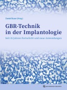 Cover-Bild zum Titel 'GBR-Technik in der Implantologie' von ''