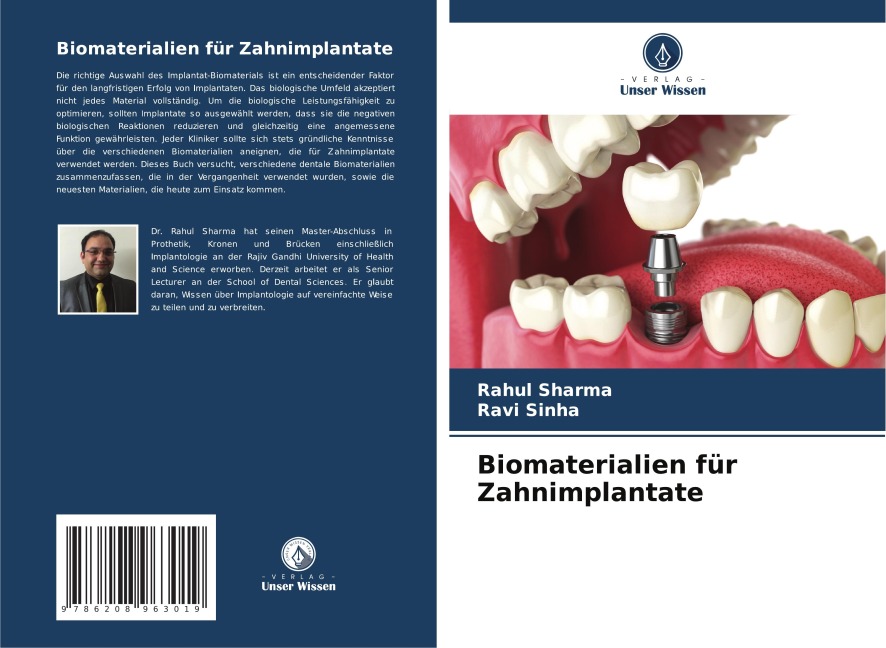 Biomaterialien für Zahnimplantate - Rahul Sharma, Ravi Sinha