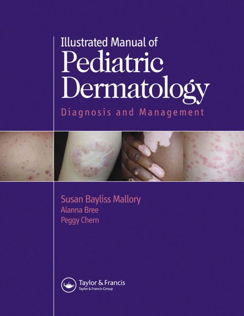 Illustrated Manual of Pediatric Dermatology - Susan Mallory, Alanna F. Bree, Peggy Chern