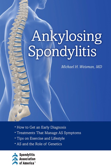 Ankylosing Spondylitis - Michael H. Weisman