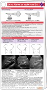 Cover-Bild zum Titel 'Sono Abdomen pocketcard Set' von 'Doreen Brodmann, Florian Recker'