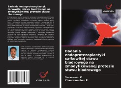 Cover-Bild zum Titel 'Badania endoprotezoplastyki ca¿kowitej stawu biodrowego na zmodyfikowanej protezie stawu biodrowego' von 'Saravanan K., Chandramohan P.'