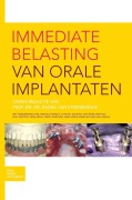 Cover-Bild zum Titel 'Immediate Belasting Van Orale Implantaten' von 'D. Steenberghe'