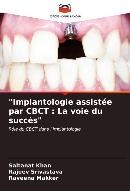 "Implantologie assistée par CBCT : La voie du succès" - Saltanat Khan, Rajeev Srivastava, Raveena Makker
