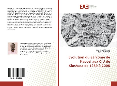 Evolution du Sarcome de Kaposi aux C.U de Kinshasa de 1989 à 2008 - Jean Bosco Mbongu, Magloire Mbenza, Nadine Mbombo
