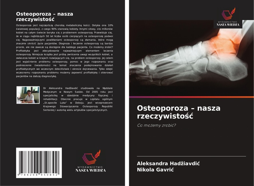 Osteoporoza - nasza rzeczywisto¿¿ - Aleksandra Had¿iavdi¿, Nikola Gavri¿