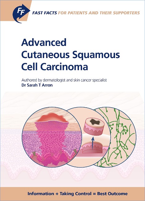 Fast Facts: Advanced Cutaneous Squamous Cell Carcinoma for Patients and their Supporters - S. T. Arron