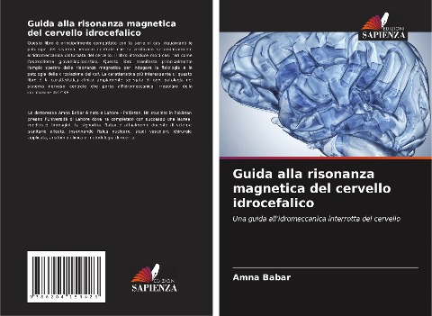 Guida alla risonanza magnetica del cervello idrocefalico - Amna Babar